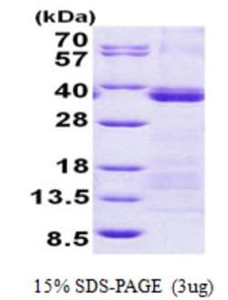 Novus Biologicals&trade;&nbsp;Recombinant Human U2AF35 His Protein
