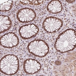 U2AF2 Antibody, Novus Biologicals 0.1mL; Unlabeled:Antibodies, Polyclonal