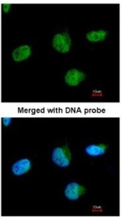 U2AF35 Antibody, Novus Biologicals 0.1mL; Unlabeled:Antibodies, Polyclonal