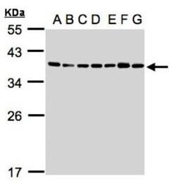 U2AF35 Antibody, Novus Biologicals 0.1mL; Unlabeled:Antibodies, Polyclonal