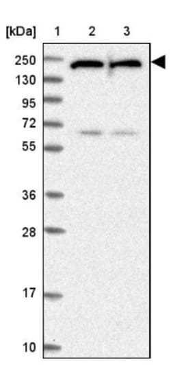 UACA Antibody, Novus Biologicals 25 &mu;L | Buy Online | Novus Biologicals | Fisher Scientific