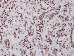 UAP56 Antibody, Novus Biologicals 0.1mL; Unlabeled:Antibodies, Polyclonal