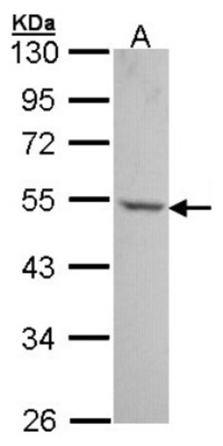 UAP56 Antibody, Novus Biologicals 0.1mL; Unlabeled:Antibodies, Polyclonal