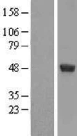 Novus Biologicals&trade;&nbsp;UAP56 Overexpression Lysate