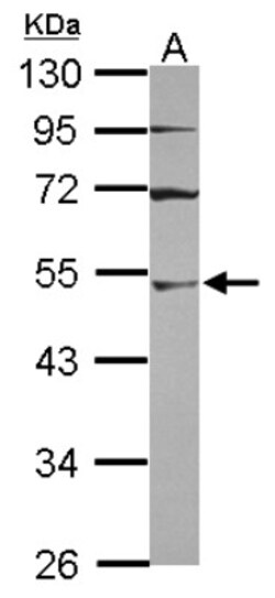 UBA3 Antibody, Novus Biologicals 0.1mL; Unlabeled:Antibodies, Polyclonal