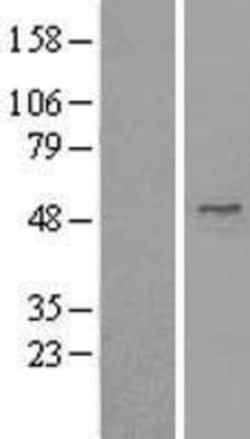 Novus Biologicals™ UBA3 Overexpression Lysate