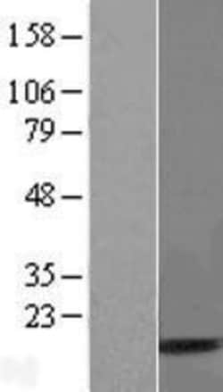 Novus Biologicals&trade;&nbsp;UBA52 Overexpression Lysate
