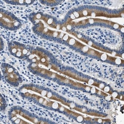 UBAC2 Antibody, Novus Biologicals:Antibodies:Primary Antibodies