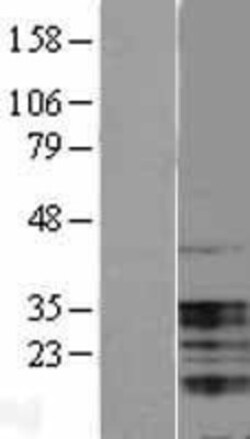 Novus Biologicals™ UBAP1 Overexpression Lysate