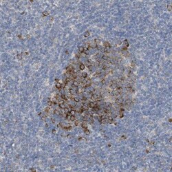 UBAP2 Antibody, Novus Biologicals 0.1mL; Unlabeled:Antibodies, Polyclonal