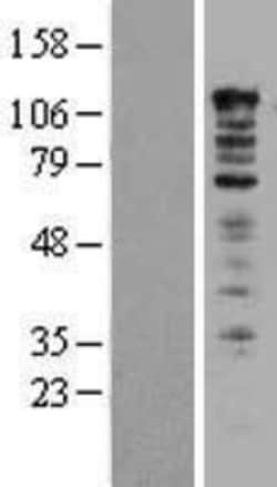 Novus Biologicals™ UBAP2L Overexpression Lysate