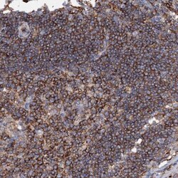 UBASH3B/STS1/Tula-2 Antibody, Novus Biologicals:Antibodies:Primary Antibodies