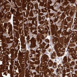 UbcH10/UBE2C Antibody, Novus Biologicals:Antibodies:Primary Antibodies