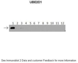 UbcH5a/UBE2D1 Antibody, Novus Biologicals 0.1mg; Unlabeled:Antibodies,