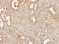 UbcH5a/UBE2D1 Antibody, Novus Biologicals 0.1mg; Unlabeled:Antibodies,