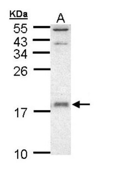 UbcH5a/UBE2D1 Antibody, Novus Biologicals 0.1mg; Unlabeled:Antibodies,