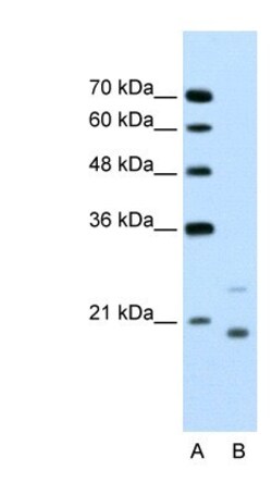 UbcH5a/UBE2D1 Antibody, Novus Biologicals 0.1mg; Unlabeled:Antibodies,