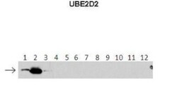 UbcH5b/UBE2D2 Antibody, Novus Biologicals:Antibodies:Primary Antibodies