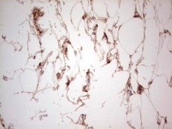 UbcH5b/UBE2D2 Antibody (OTI2C2), Novus Biologicals 0.1 mL | Buy Online | Novus Biologicals | Fisher Scientific