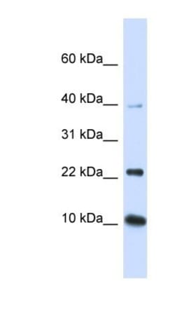 UbcH5b/UBE2D2 Antibody, Novus Biologicals:Antibodies:Primary Antibodies