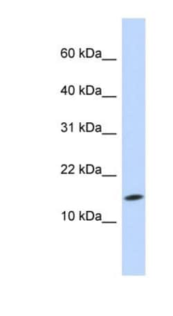UbcH5c/UBE2D3 Antibody, Novus Biologicals 0.05mg; Unlabeled:Antibodies,