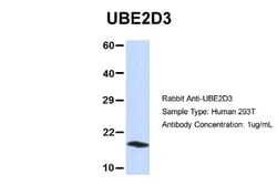 UbcH5c/UBE2D3 Antibody, Novus Biologicals 0.05mg; Unlabeled:Antibodies,