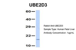 UbcH5c/UBE2D3 Antibody, Novus Biologicals 0.05mg; Unlabeled:Antibodies,