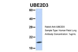 UbcH5c/UBE2D3 Antibody, Novus Biologicals 0.05mg; Unlabeled:Antibodies,