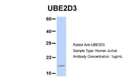 UbcH5c/UBE2D3 Antibody, Novus Biologicals 0.05mg; Unlabeled:Antibodies,