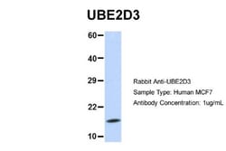 UbcH5c/UBE2D3 Antibody, Novus Biologicals 0.05mg; Unlabeled:Antibodies,