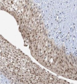 UbcH6/UBE2E1 Antibody, Novus Biologicals 0.1mL; Unlabeled:Antibodies, Polyclonal