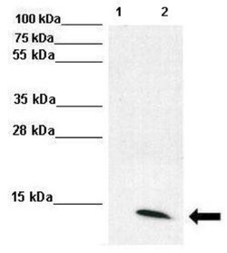 UbcH8/Ube2L6 Antibody, Novus Biologicals 100&mu;L; Unlabeled:Antibodies,