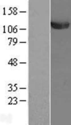 Novus Biologicals&trade;&nbsp;Ubiquitin-activating Enzyme/UBE1 Overexpression Lysate