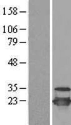 Novus Biologicals&trade;&nbsp;UbcH10/UBE2C Overexpression Lysate