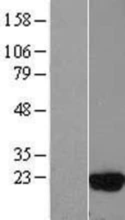 Novus Biologicals™ UbcH5c/UBE2D3 Overexpression Lysate