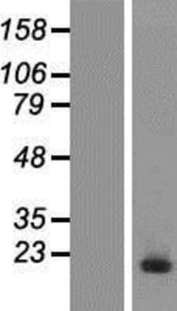Novus Biologicals&trade;&nbsp;UbcH5c/UBE2D3 Overexpression Lysate