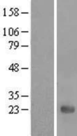 Novus Biologicals™ UBE2E3 Overexpression Lysate