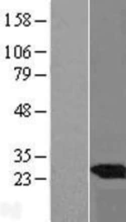 Novus Biologicals&trade;&nbsp;UBE2E3 Overexpression Lysate