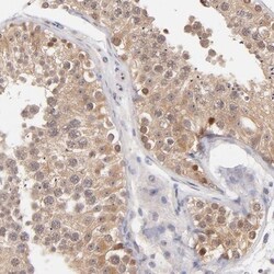 CD38 Antibody, Novus Biologicals:Antibodies:Primary Antibodies