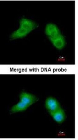 UBE2G2 Antibody, Novus Biologicals 0.1mg; Unlabeled:Antibodies, Polyclonal