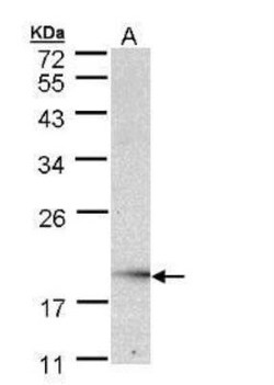 UBE2G2 Antibody, Novus Biologicals 0.1mg; Unlabeled:Antibodies, Polyclonal
