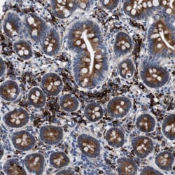 CPS1 Antibody, Novus Biologicals:Antibodies:Primary Antibodies