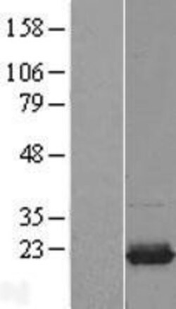Novus Biologicals™ UBE2I/Ubc9 Overexpression Lysate