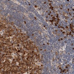 UBE2J1 Antibody, Novus Biologicals:Antibodies:Primary Antibodies