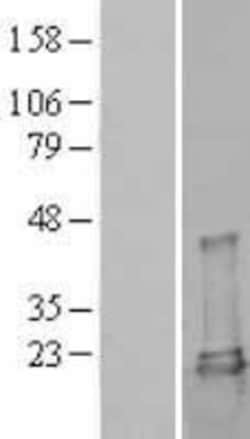 Novus Biologicals&trade;&nbsp;UbcH7/UBE2L3 Overexpression Lysate