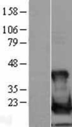 Novus Biologicals&trade;&nbsp;UbcH8/Ube2L6 Overexpression Lysate