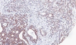 UBE2M/Ubc12 Antibody, Novus Biologicals 0.1mL; Unlabeled:Antibodies, Polyclonal