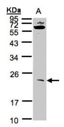 UBE2M/Ubc12 Antibody, Novus Biologicals 0.1mL; Unlabeled:Antibodies, Polyclonal