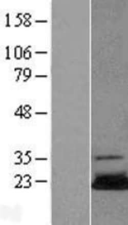 Novus Biologicals&trade;&nbsp;UBE2N/Ubc13 Overexpression Lysate