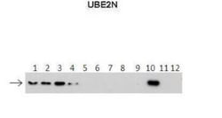 UBE2N/Ubc13 Antibody, Novus Biologicals 20&mu;L; Unlabeled:Antibodies,